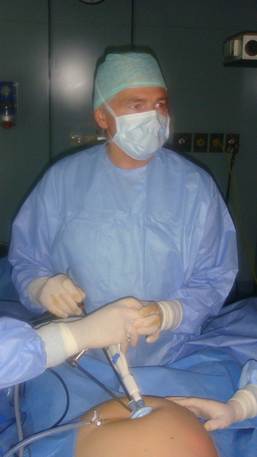  chirurgia laparoscopica roma 